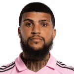 D. Yedlin profile