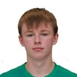 C. Noonan profile