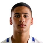 B. Poggenpoel profile
