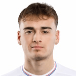 A. Anello profile