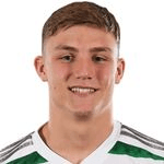 D. Murray profile