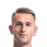 A. Memic profile